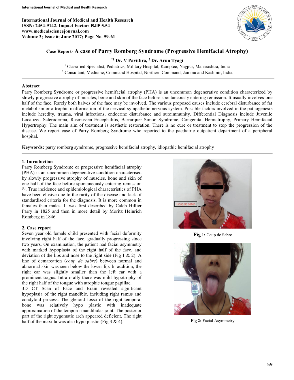 Progressive Hemifacial Atrophy) *1 Dr