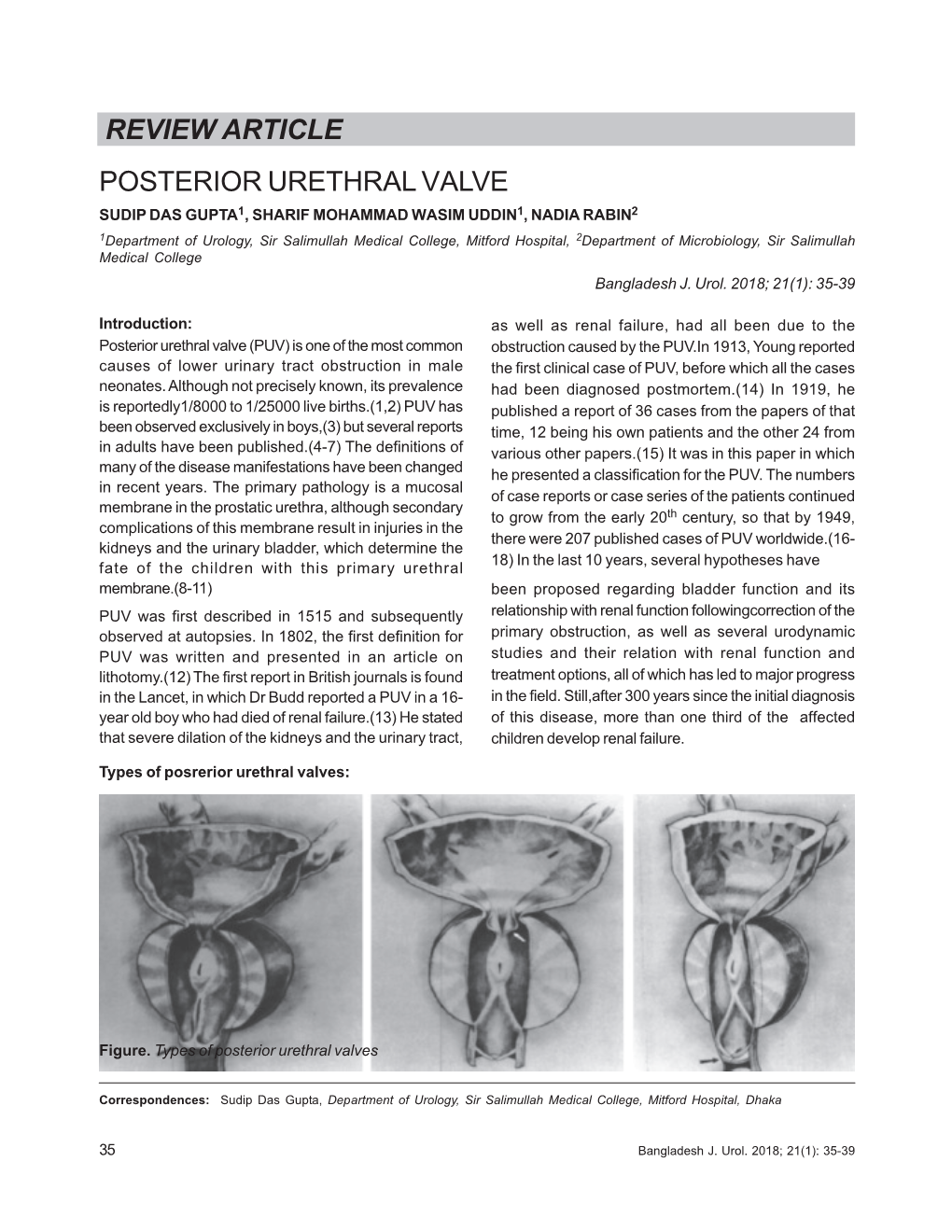 Review Article Posterior Urethral Valve