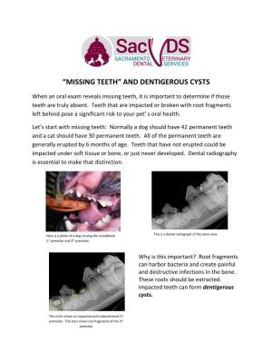 “Missing Teeth” and Dentigerous Cysts