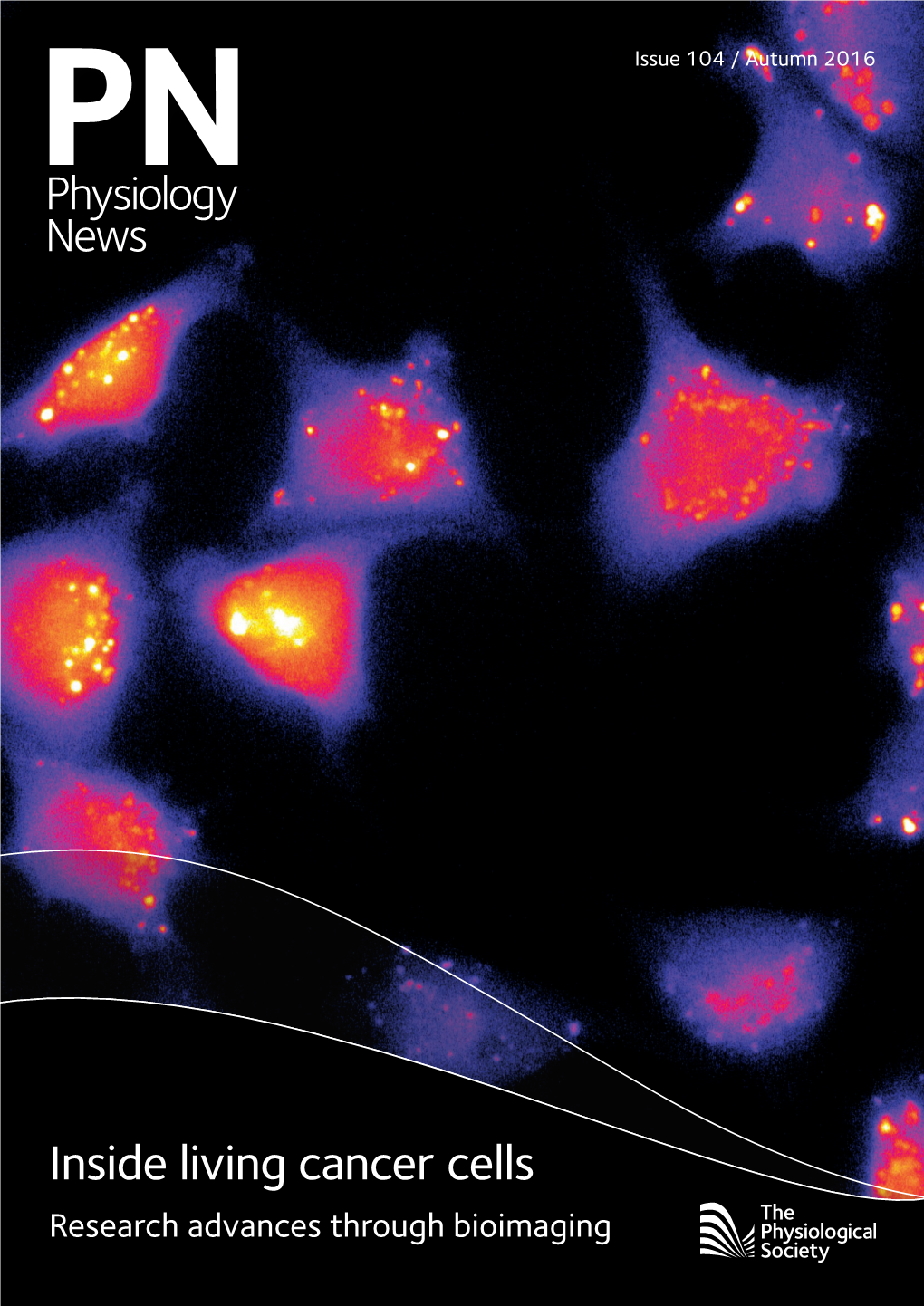 Inside Living Cancer Cells Research Advances Through Bioimaging