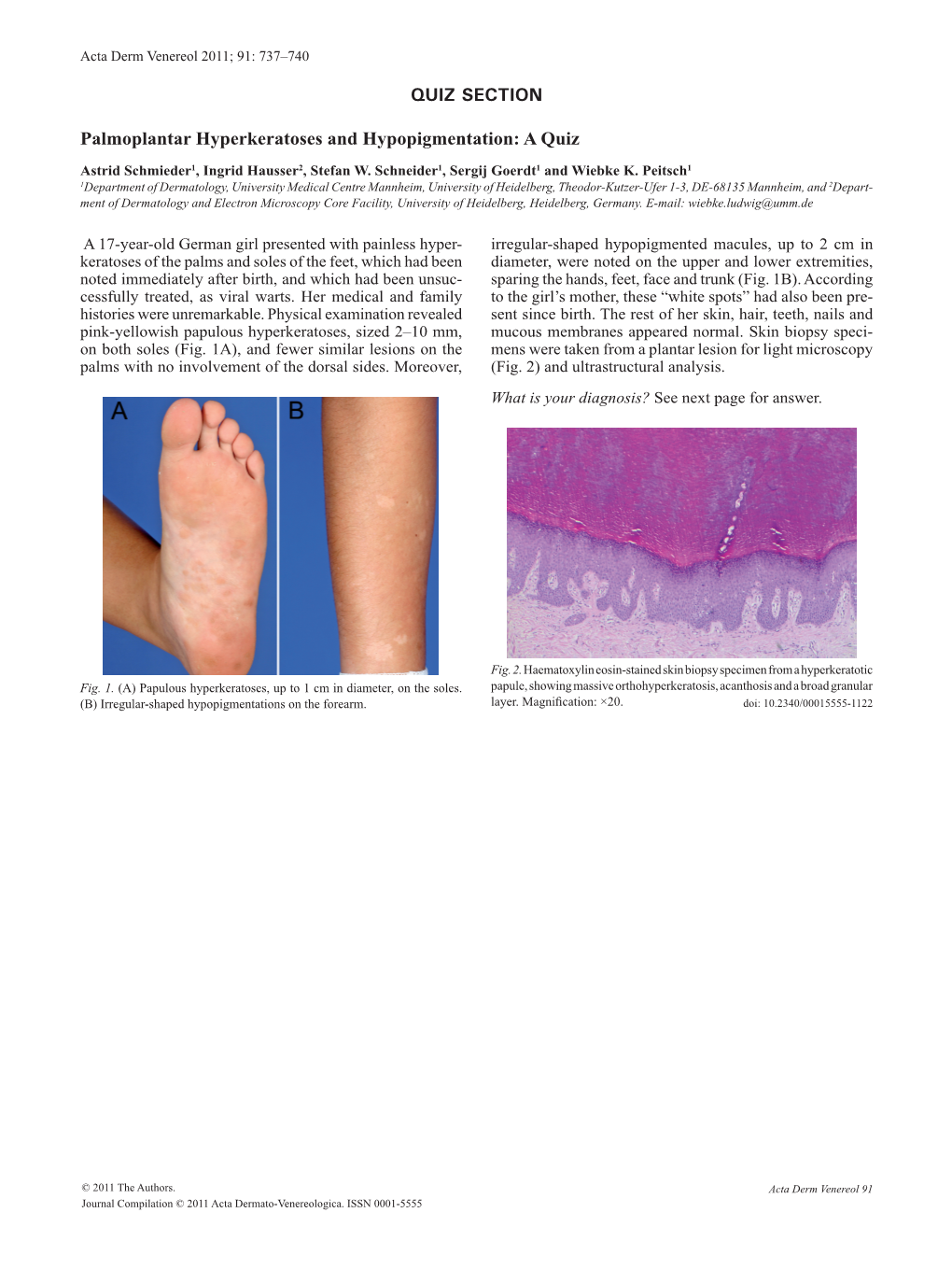 QUIZ SECTION Palmoplantar Hyperkeratoses And