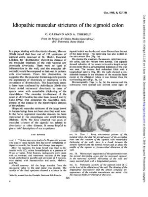 Idiopathic Muscular Strictures Ofthe Sigmoid Colon