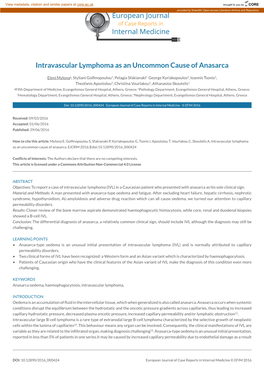 Intravascular Lymphoma As an Uncommon Cause of Anasarca