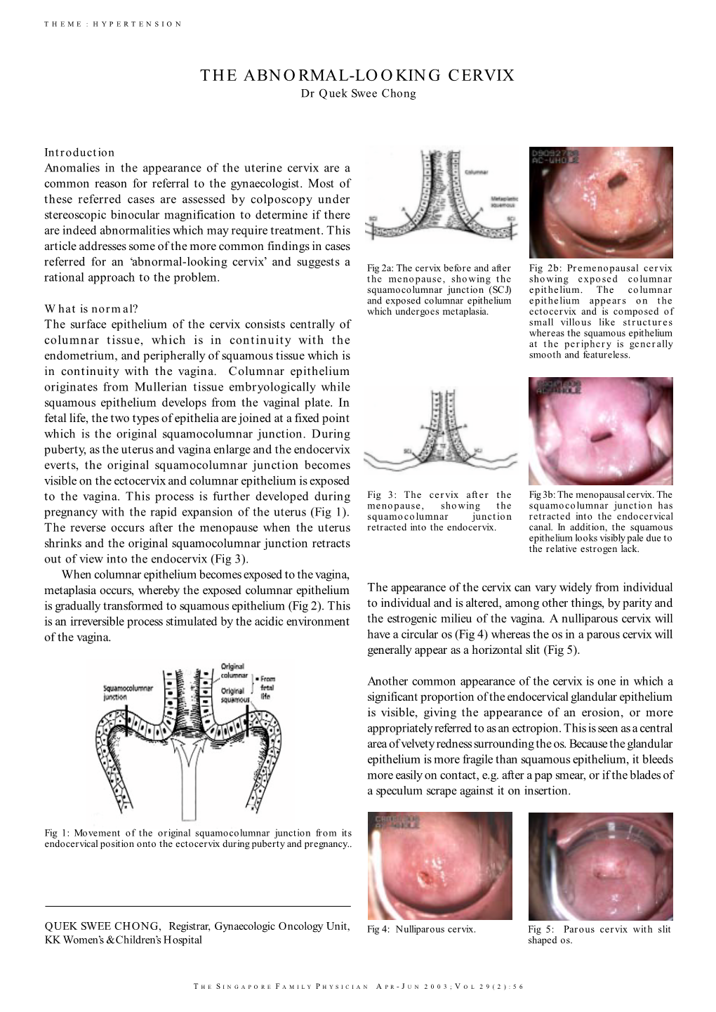 THE ABNORMAL-LOOKING CERVIX Dr Quek Swee Chong