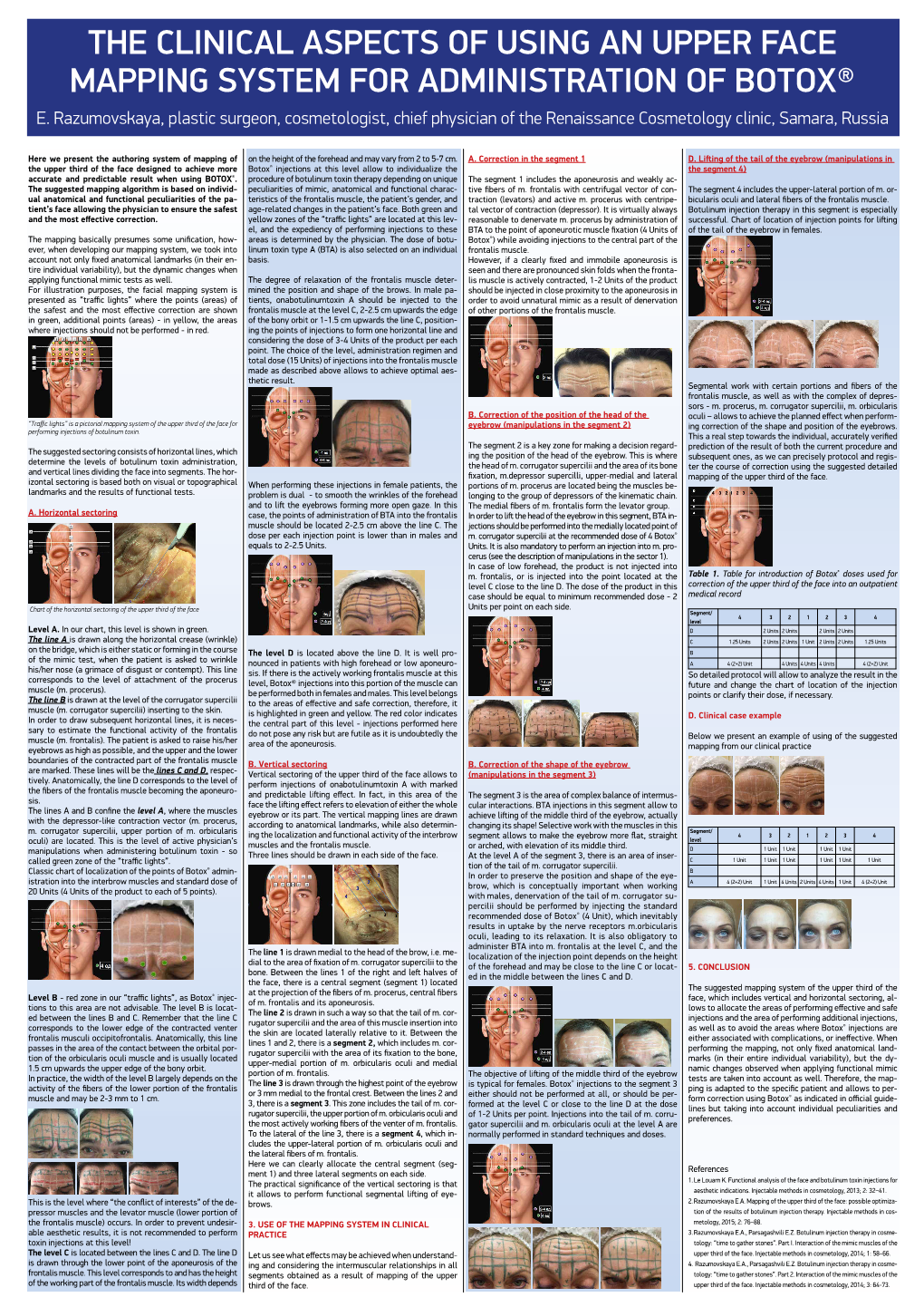 Clinical Aspects of Using an Upper Face Mapping System for Administration of Botox® E