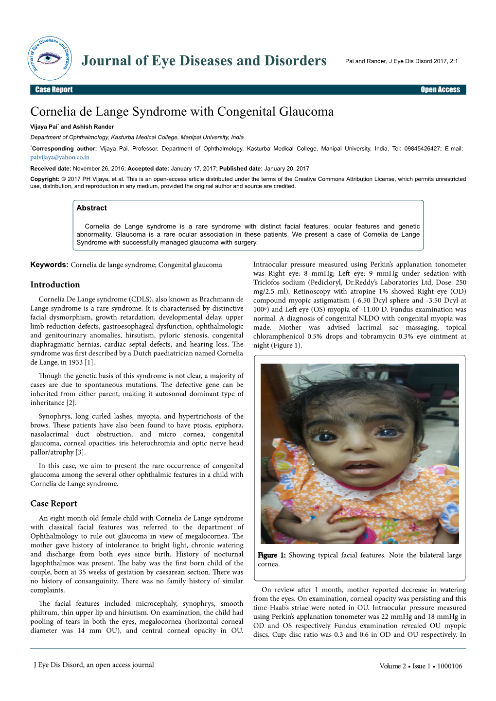 Cornelia De Lange Syndrome with Congenital Glaucoma