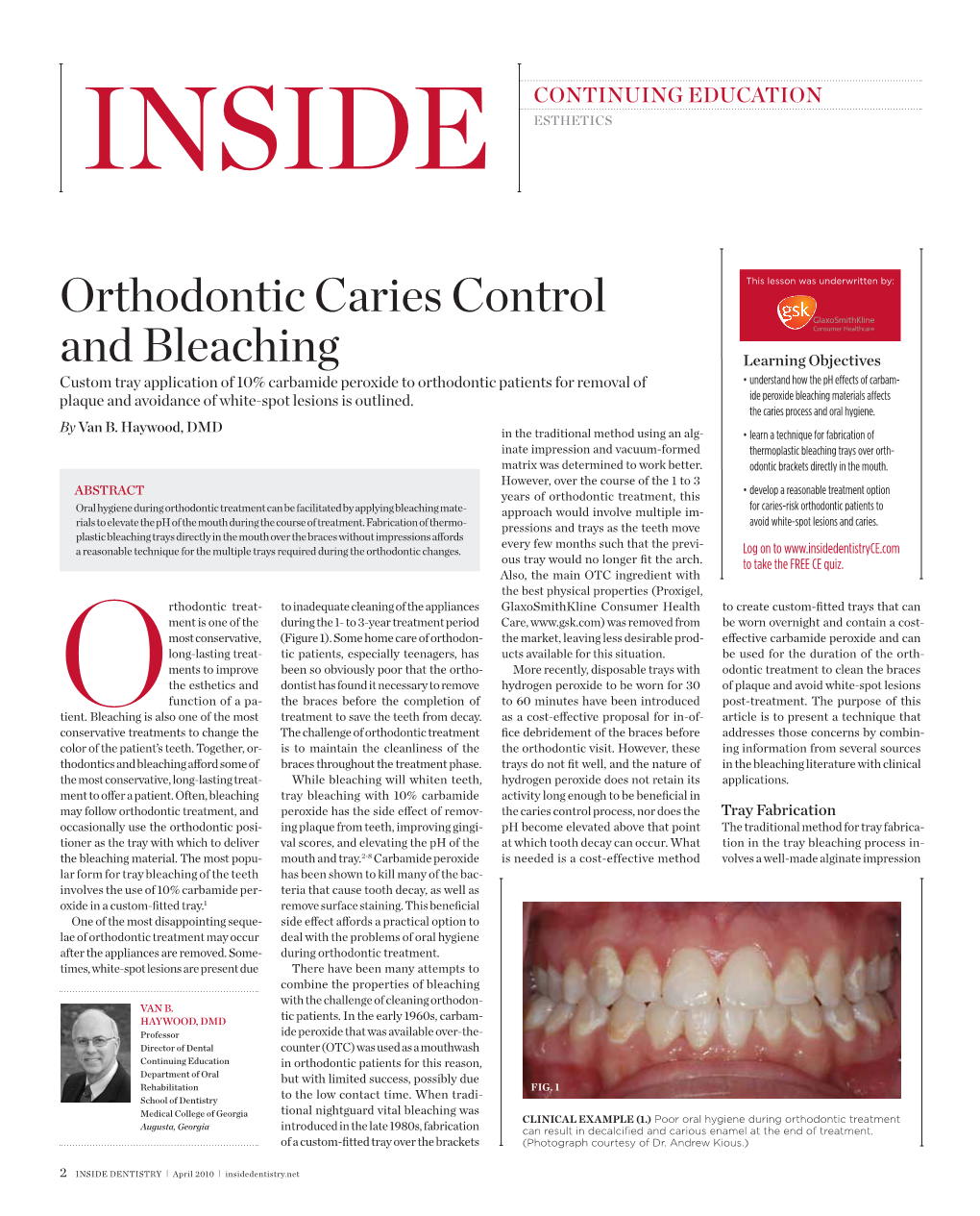 Orthodontic Caries Control and Bleaching