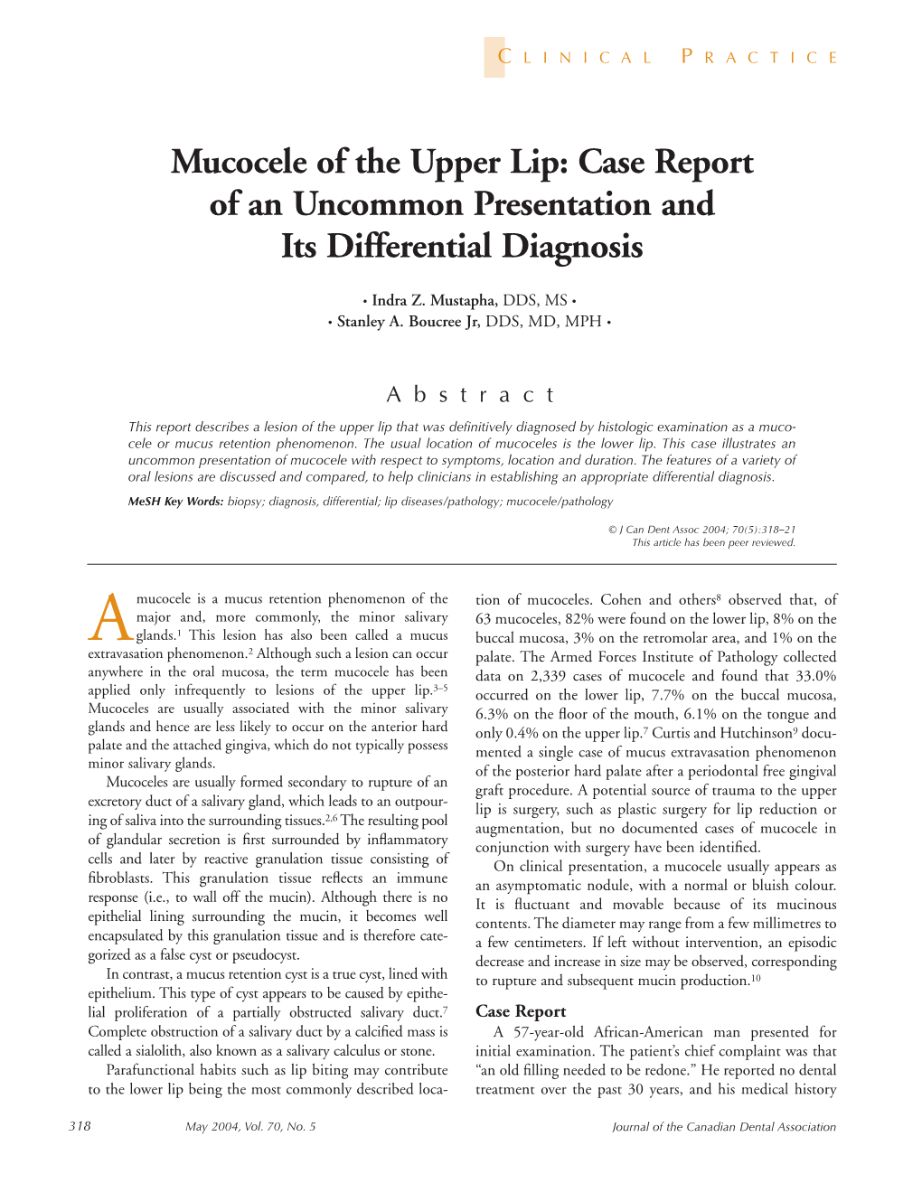 Mucocele of the Upper Lip: Case Report of an Uncommon Presentation and Its Differential Diagnosis
