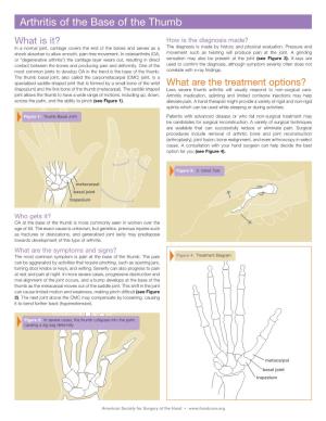Arthritis of the Base of the Thumb