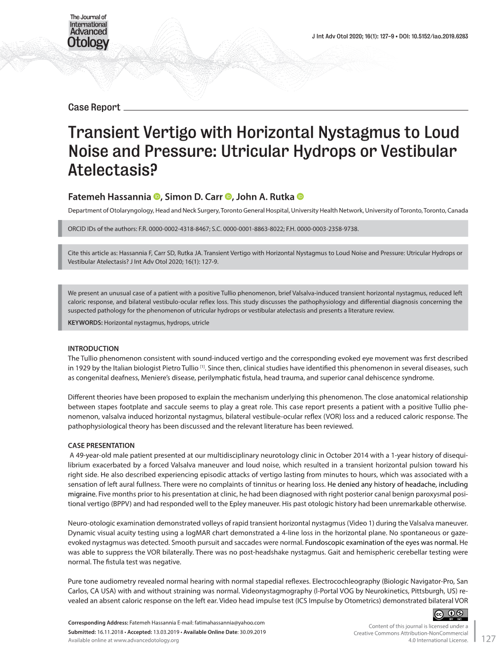 Transient Vertigo with Horizontal Nystagmus to Loud Noise and Pressure: Utricular Hydrops Or Vestibular Atelectasis?