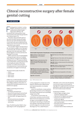 Clitoral Reconstructive Surgery After Female Genital Cutting