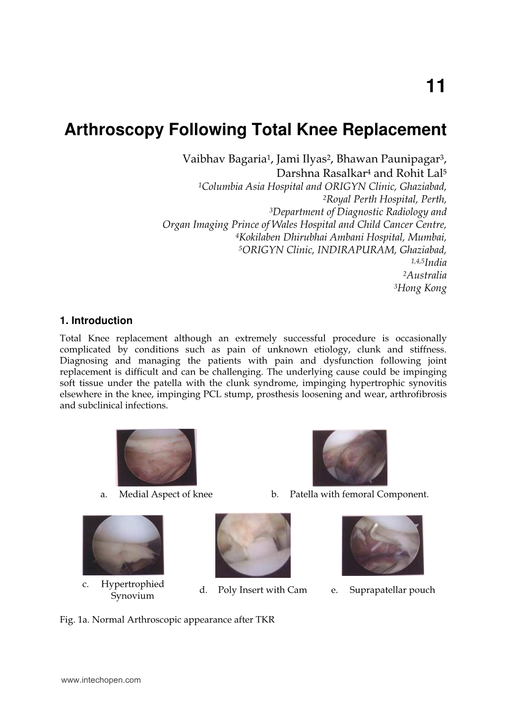 Arthroscopy Following Total Knee Replacement