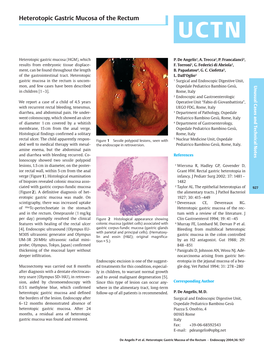 Heterotopic Gastric Mucosa of the Rectum UCTN