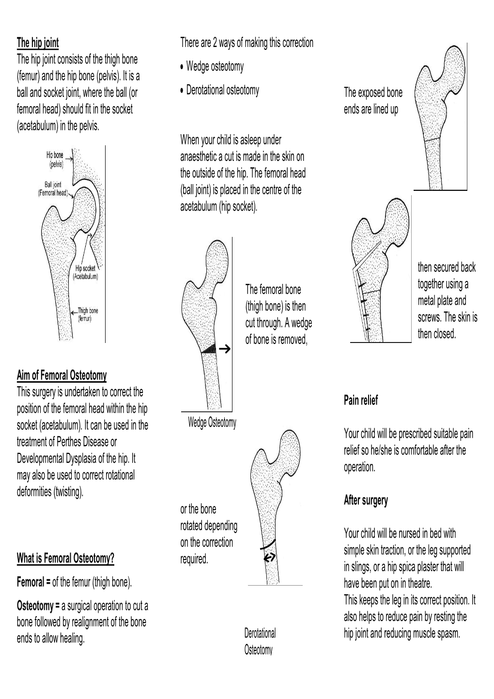 The Hip Joint Aim of Femoral Osteotomy What Is Femoral