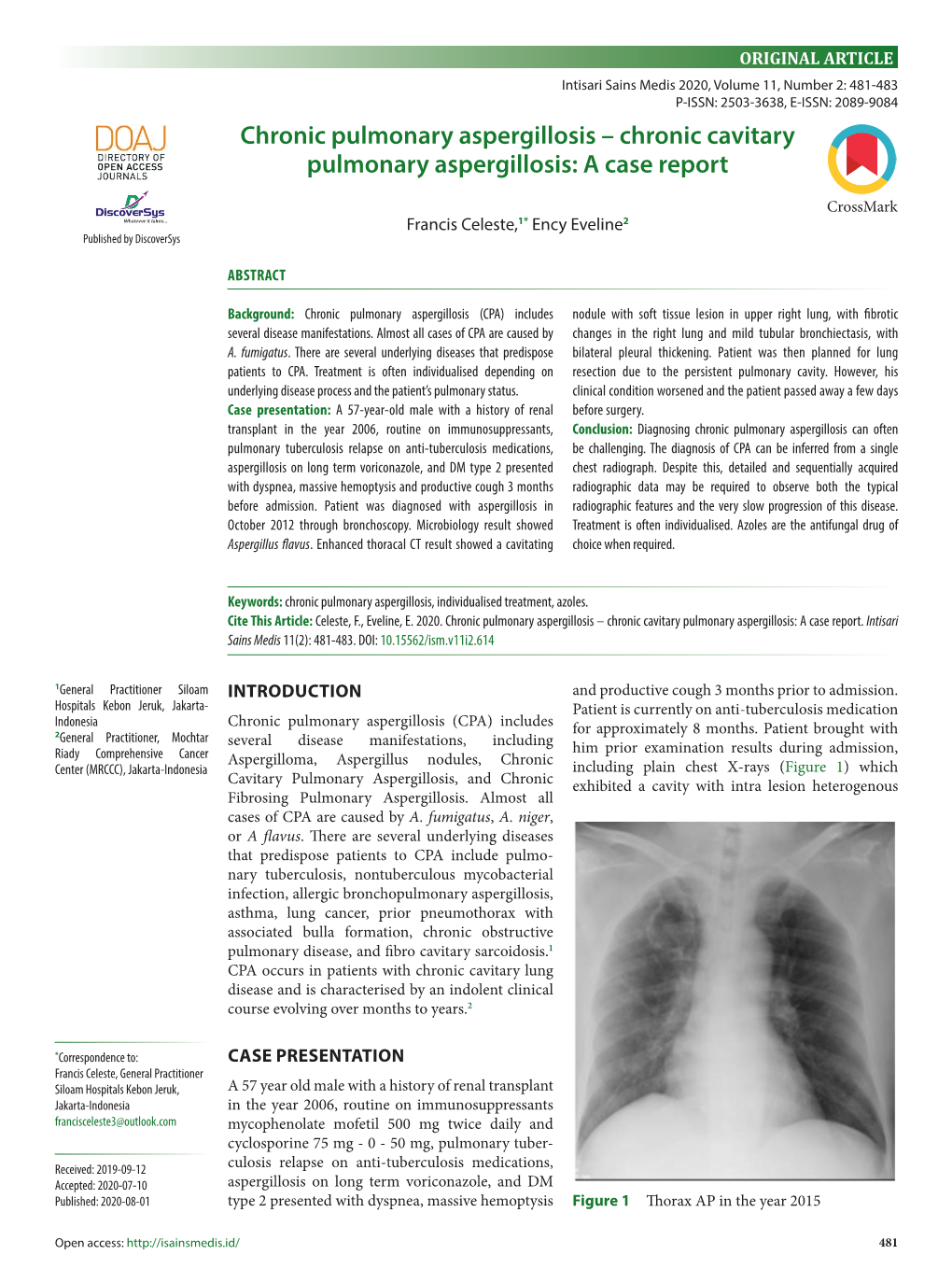 Chronic Cavitary Pulmonary Aspergillosis: a Case Report