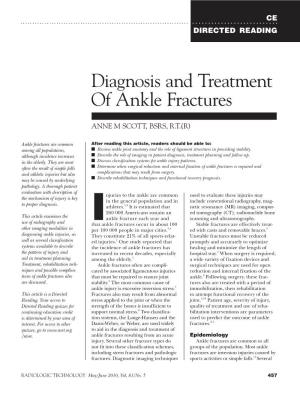 Diagnosis and Treatment of Ankle Fractures