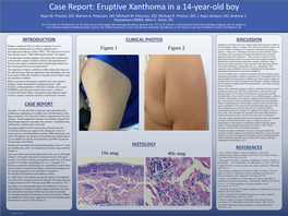 Case Report: Eruptive Xanthoma in a 14-Year-Old Boy Ryan M