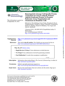 Chemotaxis in Dendritic Cells Podosome Array Organization And