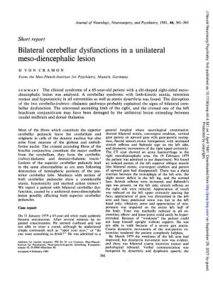 Bilateral Cerebellar Dysfunctions in a Unilateral Meso-Diencephalic Lesion