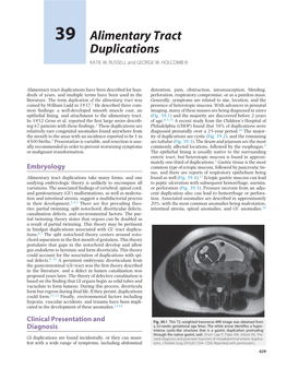 Alimentary Tract Duplications KATIE W