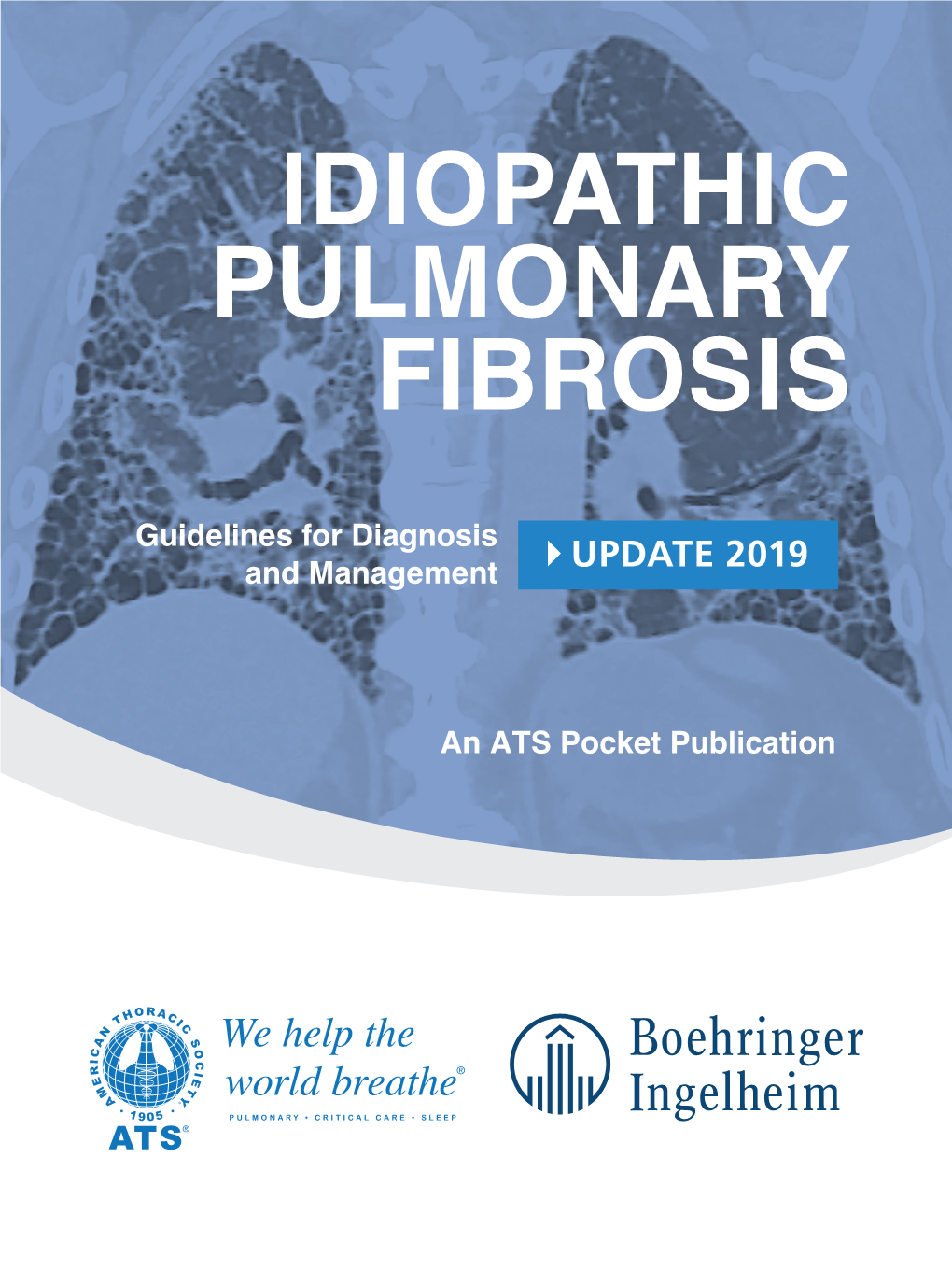 Idiopathic Pulmonary Fibrosis