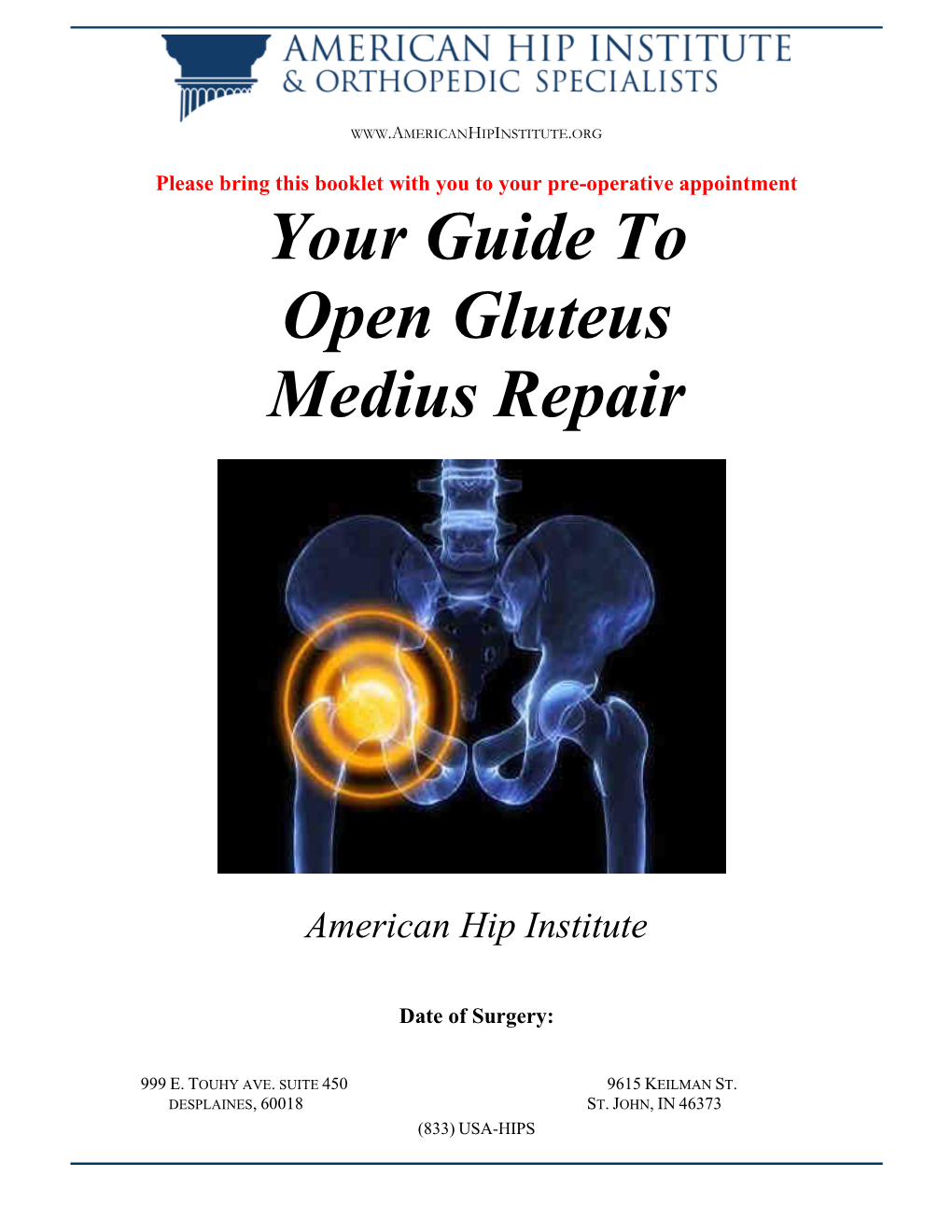 Your Guide to Open Gluteus Medius Repair