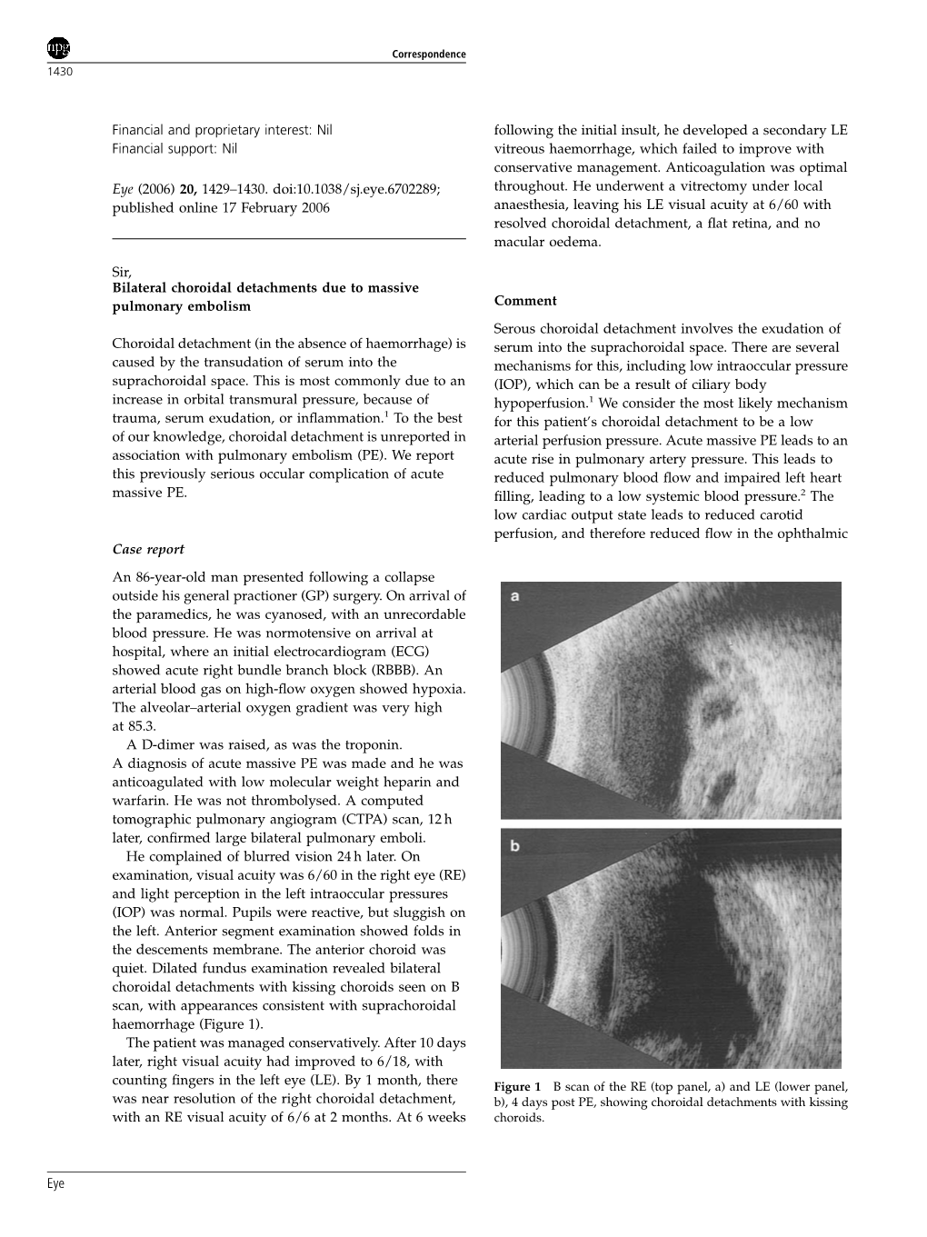 Financial and Proprietary Interest: Nil Financial Support: Nil Eye (2006) 20, 1429–1430. Doi:10.1038/Sj.Eye.6702289; Published