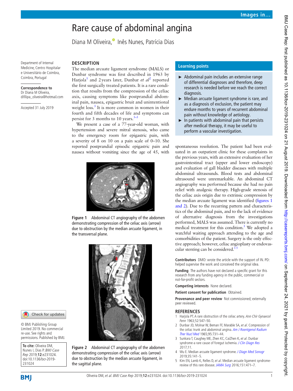 Rare Cause of Abdominal Angina Diana M Oliveira, Inês Nunes, Patrícia Dias