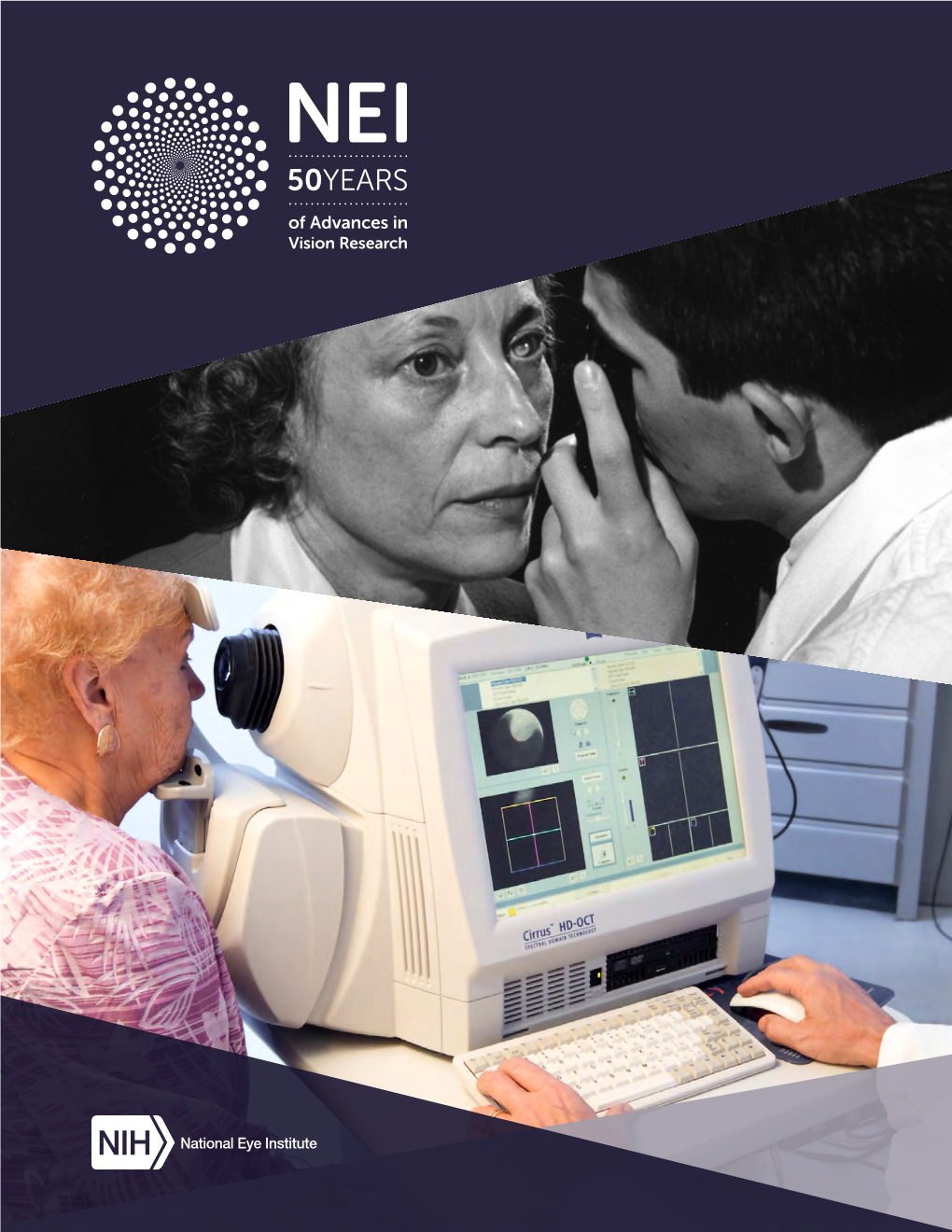 NEI 50 Years of Advance in Vision Research