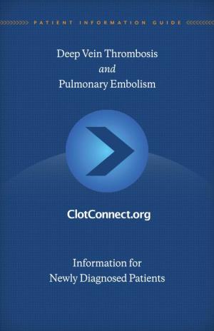 Deep Vein Thrombosis and Pulmonary Embolism Information for Newly Diagnosed Patients