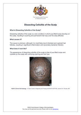 Dissecting Cellulitis of the Scalp