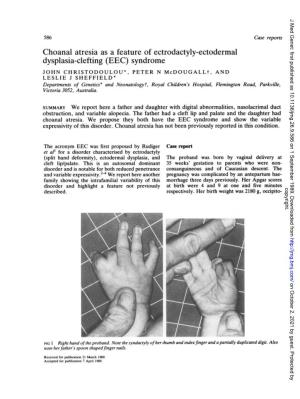 Choanal Atresia As a Feature of Ectrodactyly-Ectodermal Dysplasia