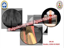 Pulpotomy and Apexification