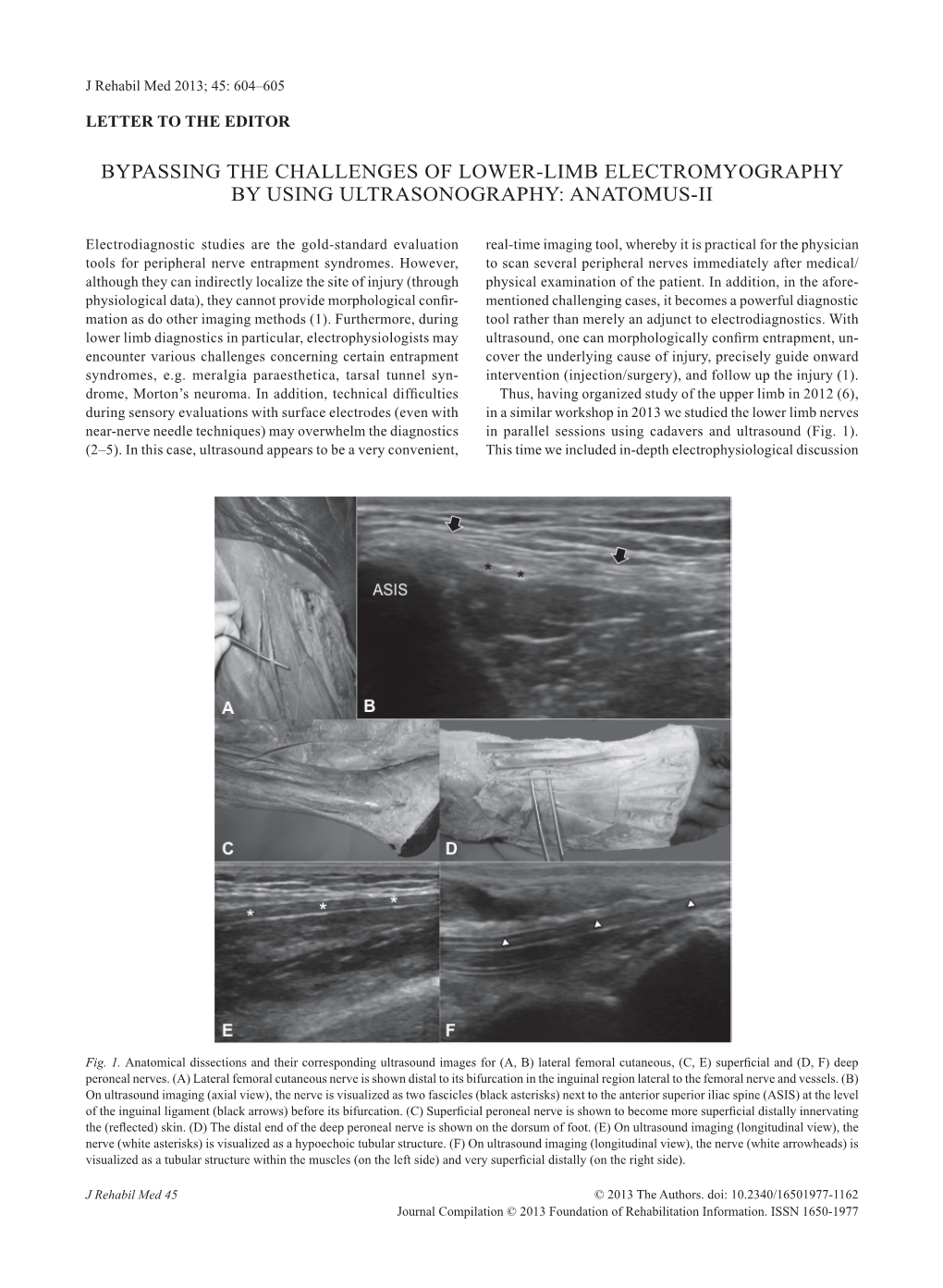 Bypassing the Challenges of Lower-Limb ELECTROMYOGRAPHY by Using Ultrasonography: Anatomus-II