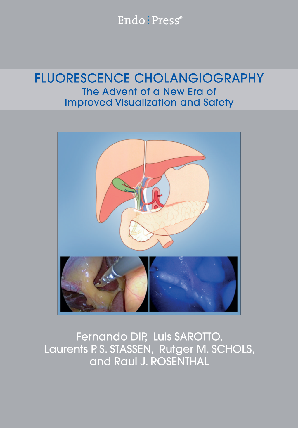 FLUORESCENCE CHOLANGIOGRAPHY the Advent of a New Era of Improved Visualization and Safety