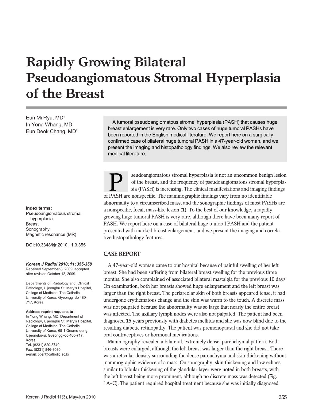 Rapidly Growing Bilateral Pseudoangiomatous Stromal Hyperplasia of the Breast