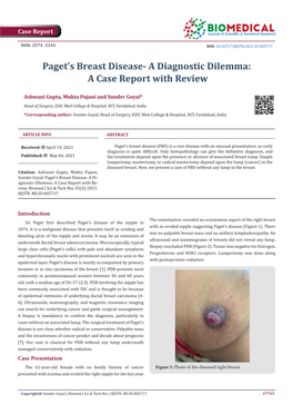 Paget's Breast Disease- a Diagnostic Dilemma: a Case Report with Review