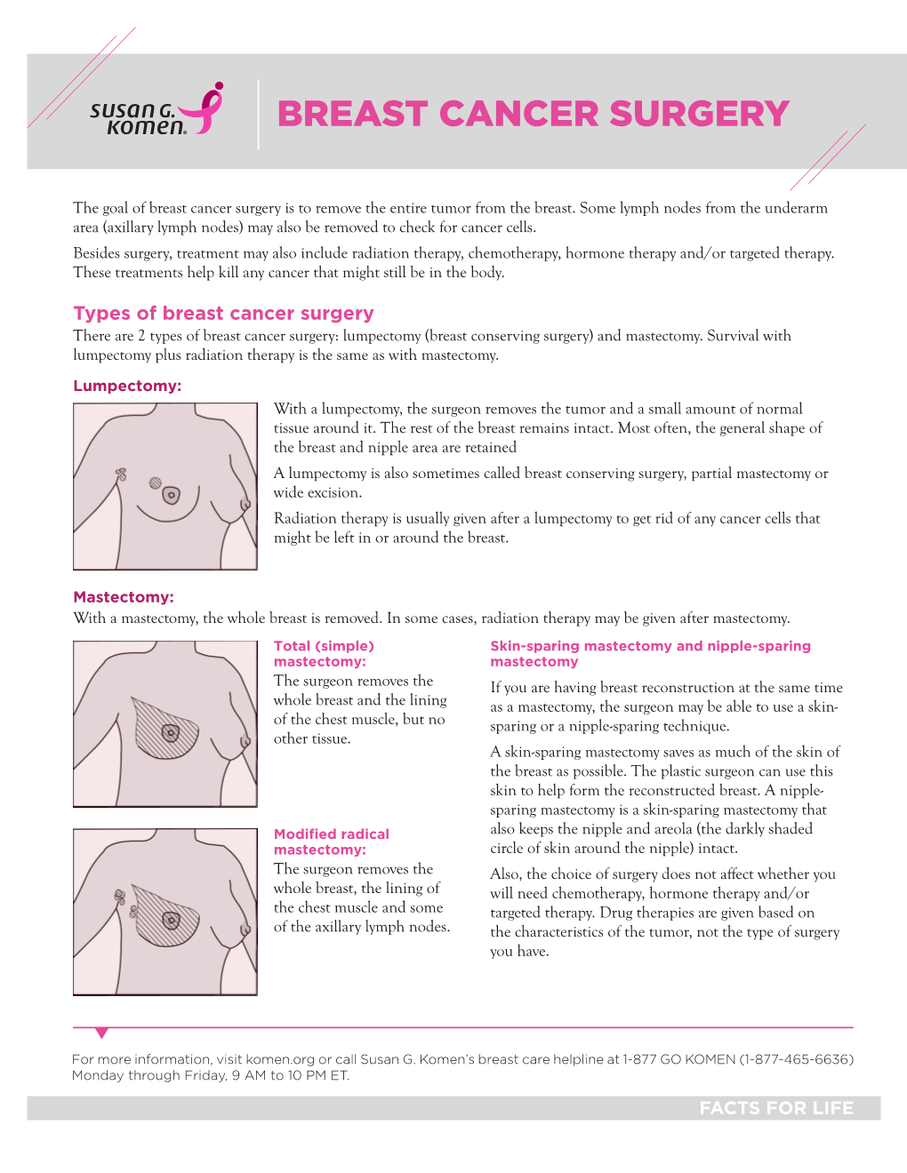 Breast Cancer Surgery