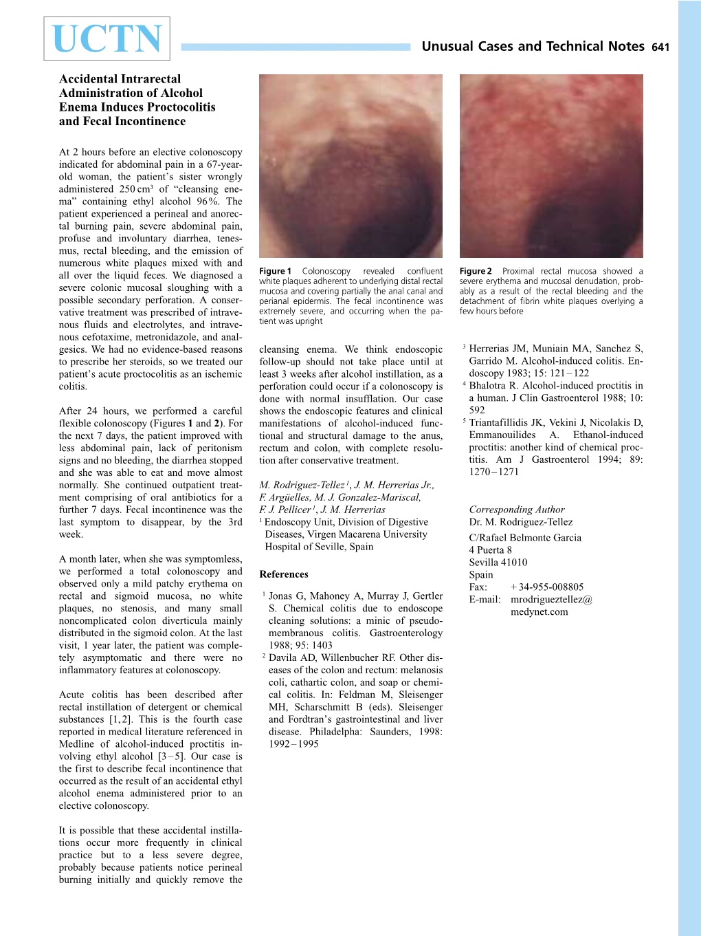 Accidental Intrarectal Administration of Alcohol Enema Induces Proctocolitis and Fecal Incontinence