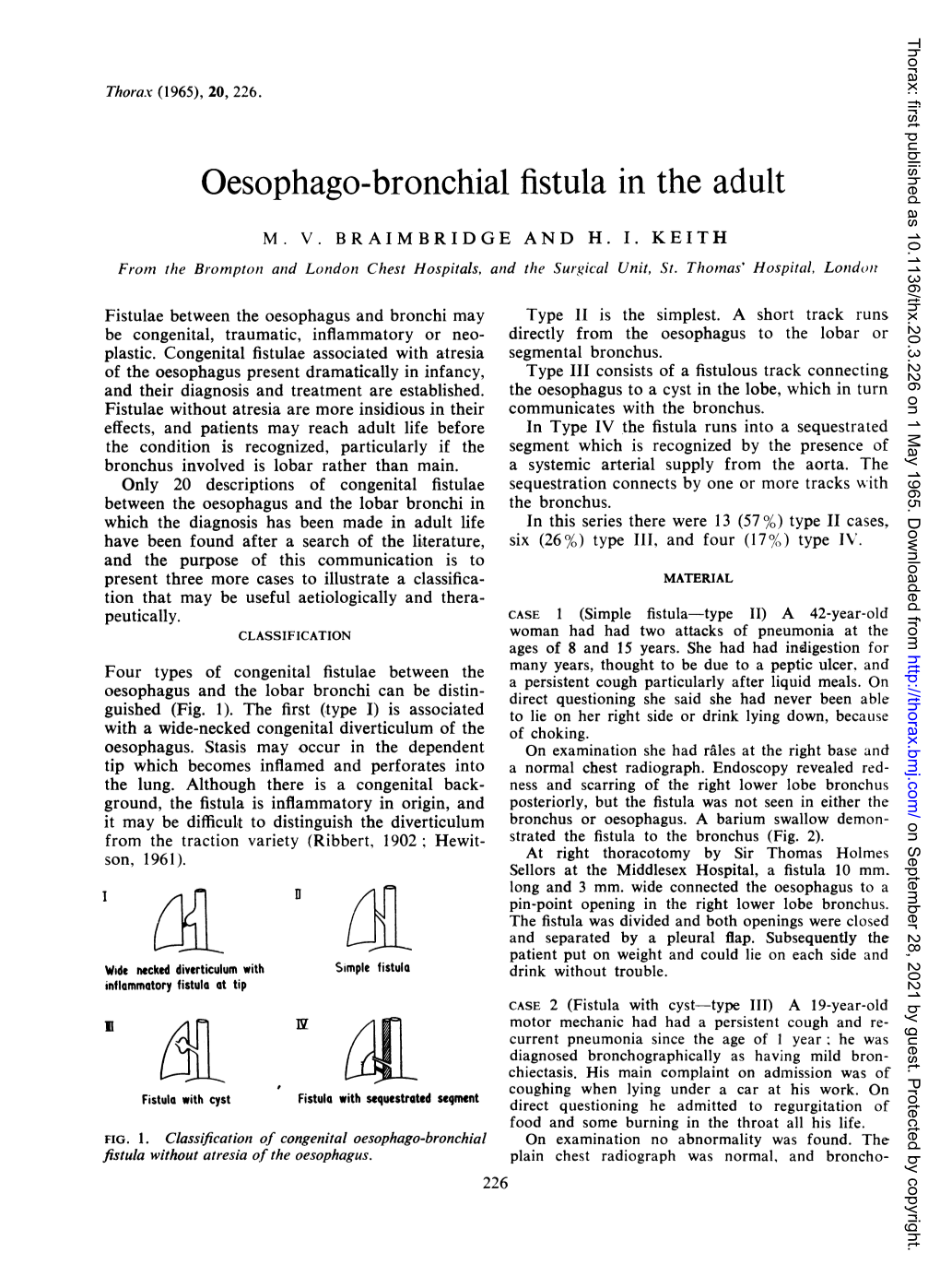 Oesophago-Bronchial Fistulain the Adult