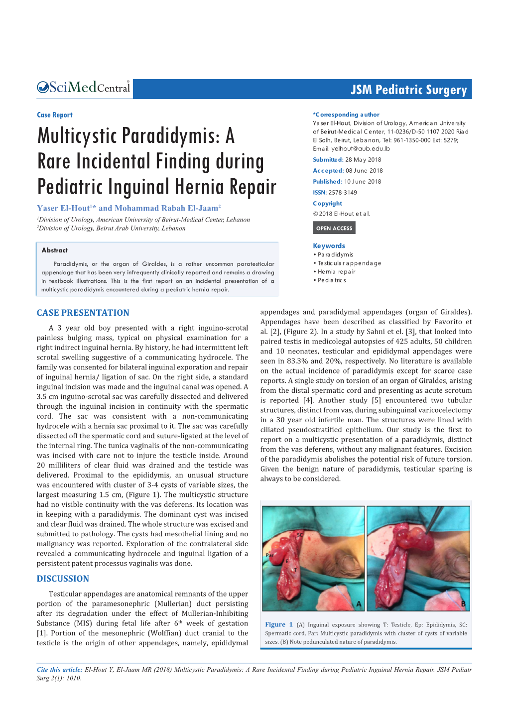 Multicystic Paradidymis: a Rare Incidental Finding During Pediatric Inguinal Hernia Repair