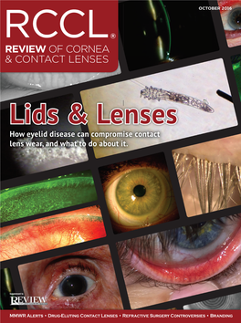 Review of Cornea & Contact Lenses