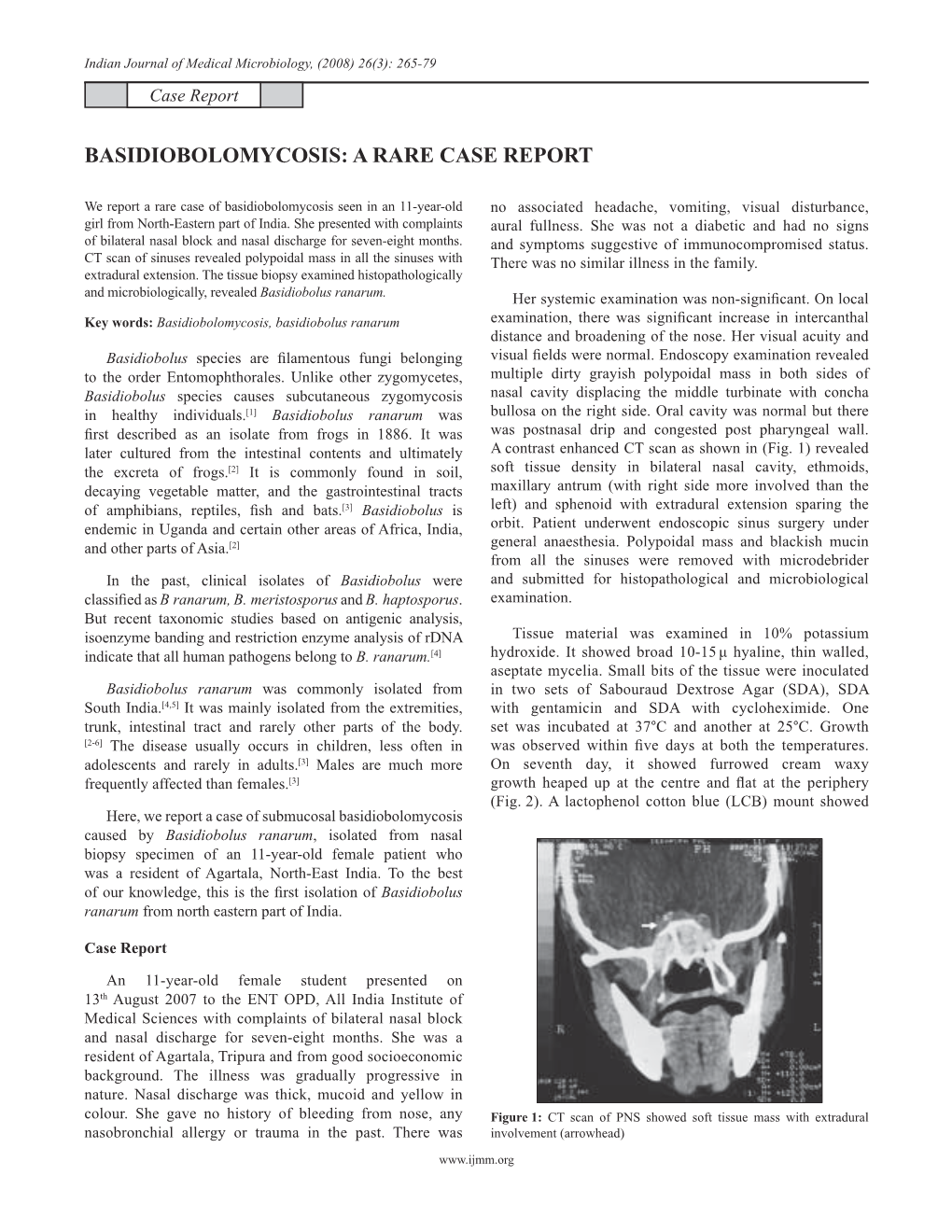 Basidiobolomycosis: a Rare Case Report