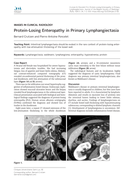 Protein-Losing Enteropathy in Primary Lymphangiectasia