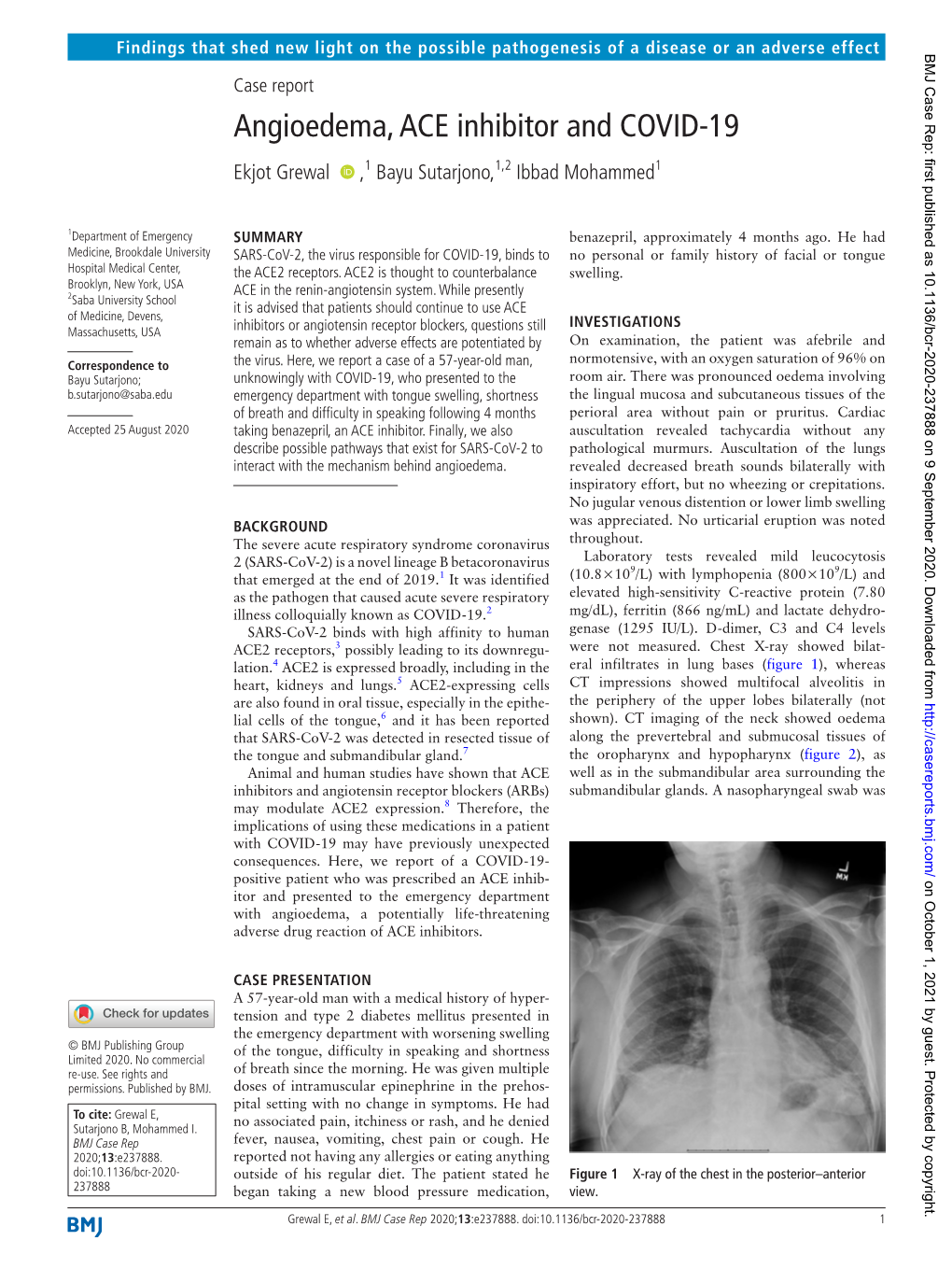 Angioedema, ACE Inhibitor and COVID-19 Ekjot Grewal ‍ ‍ ,1 Bayu Sutarjono,1,2 Ibbad Mohammed1