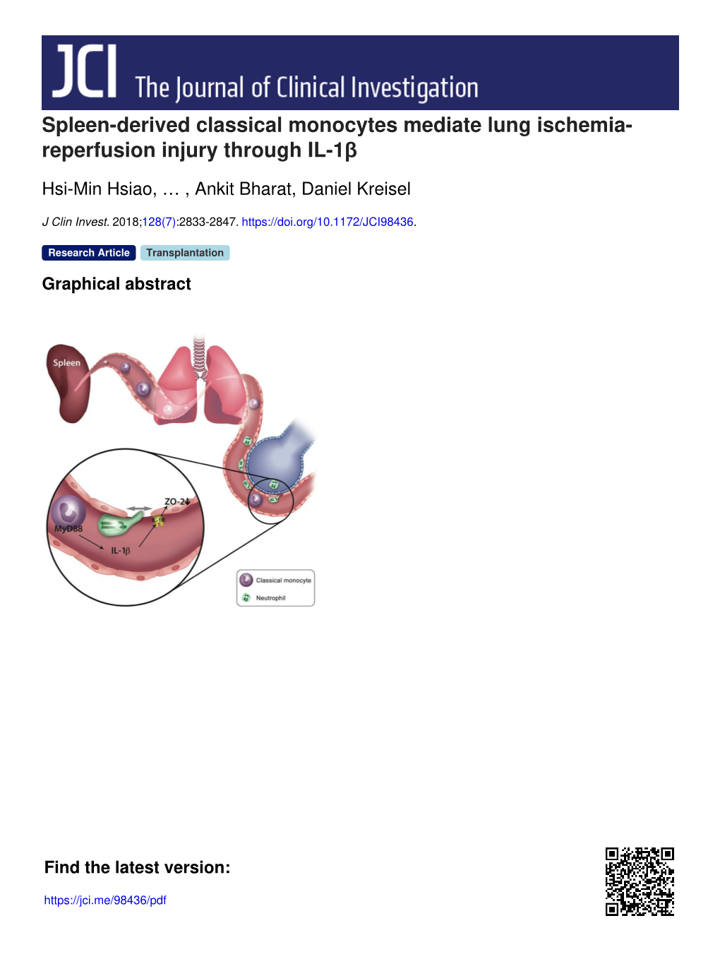 Spleen-Derived Classical Monocytes Mediate Lung Ischemia- Reperfusion Injury Through IL-1Β