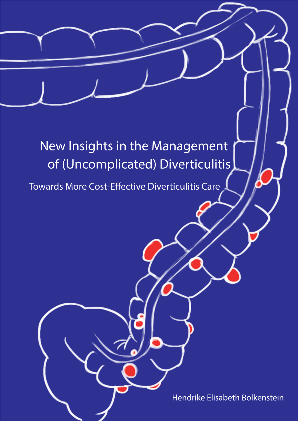 (Uncomplicated) Diverticulitis