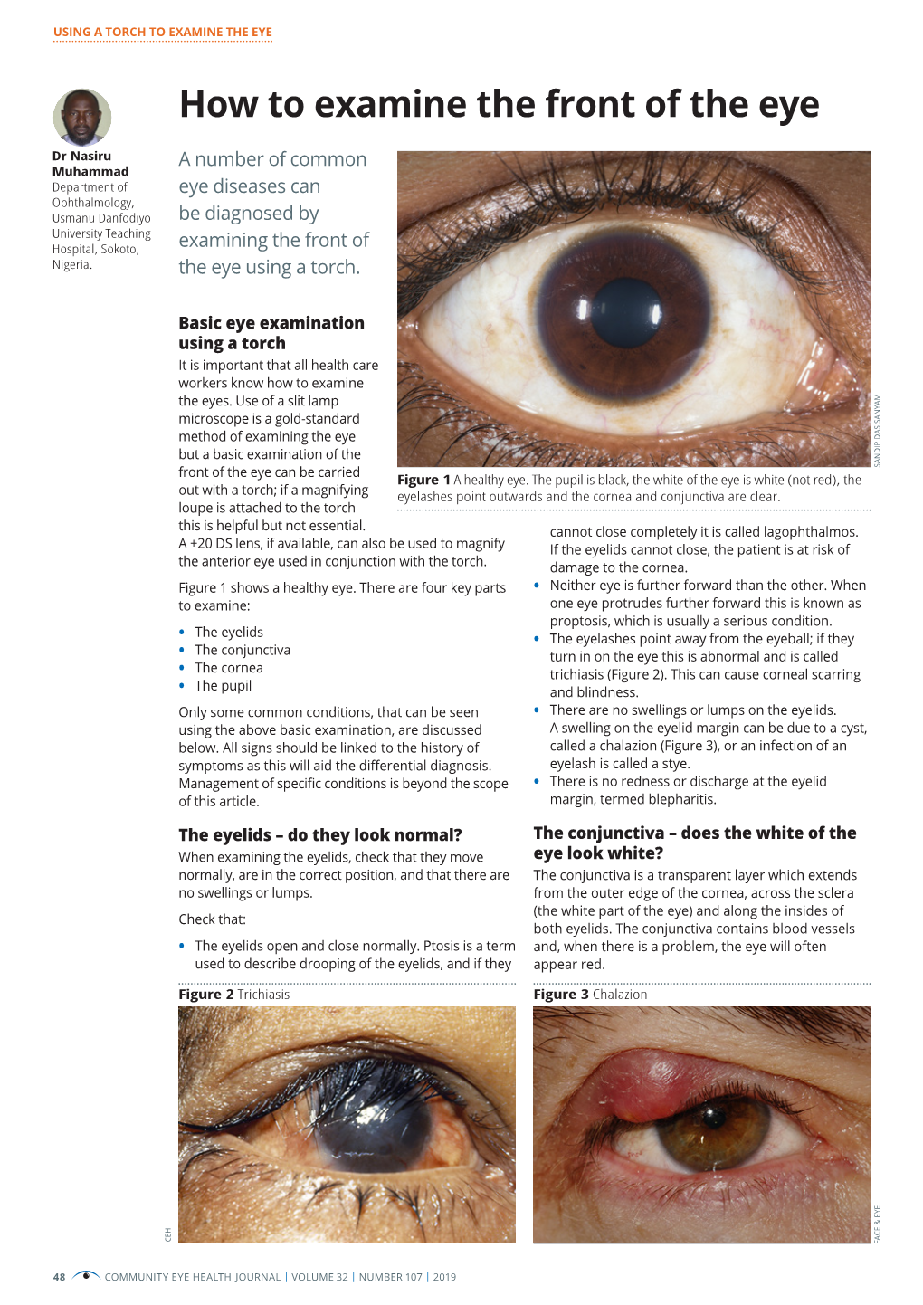 How to Examine the Front of the Eye