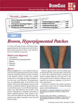 Brown, Hyperpigmented Patches