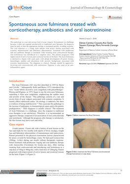 Spontaneous Acne Fulminans Treated with Corticotherapy, Antibiotics and Oral Isotretinoine
